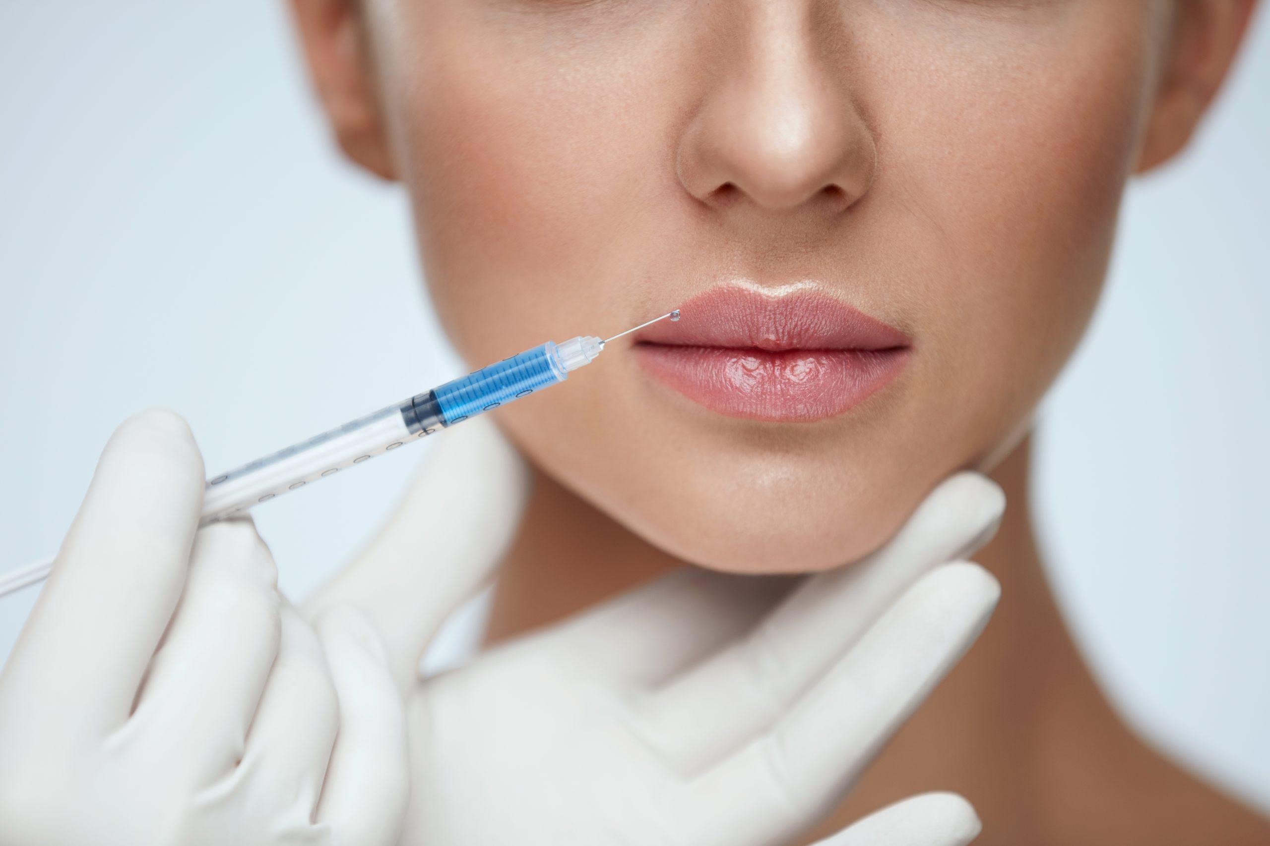 MY AESTHETICS: Die erste Wahl für Lippen Aufspritzen Nürnberg